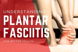 Understanding plantar fasciitis